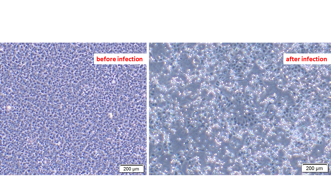 Cytopathic effect in Vero E6 cells infected with virus isolated from COVID-19 patient.