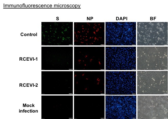 RCEVI-1 and RCEVI-2 show inhibitory effects on SARS- CoV-2 infection by immunofluorescence microscopy